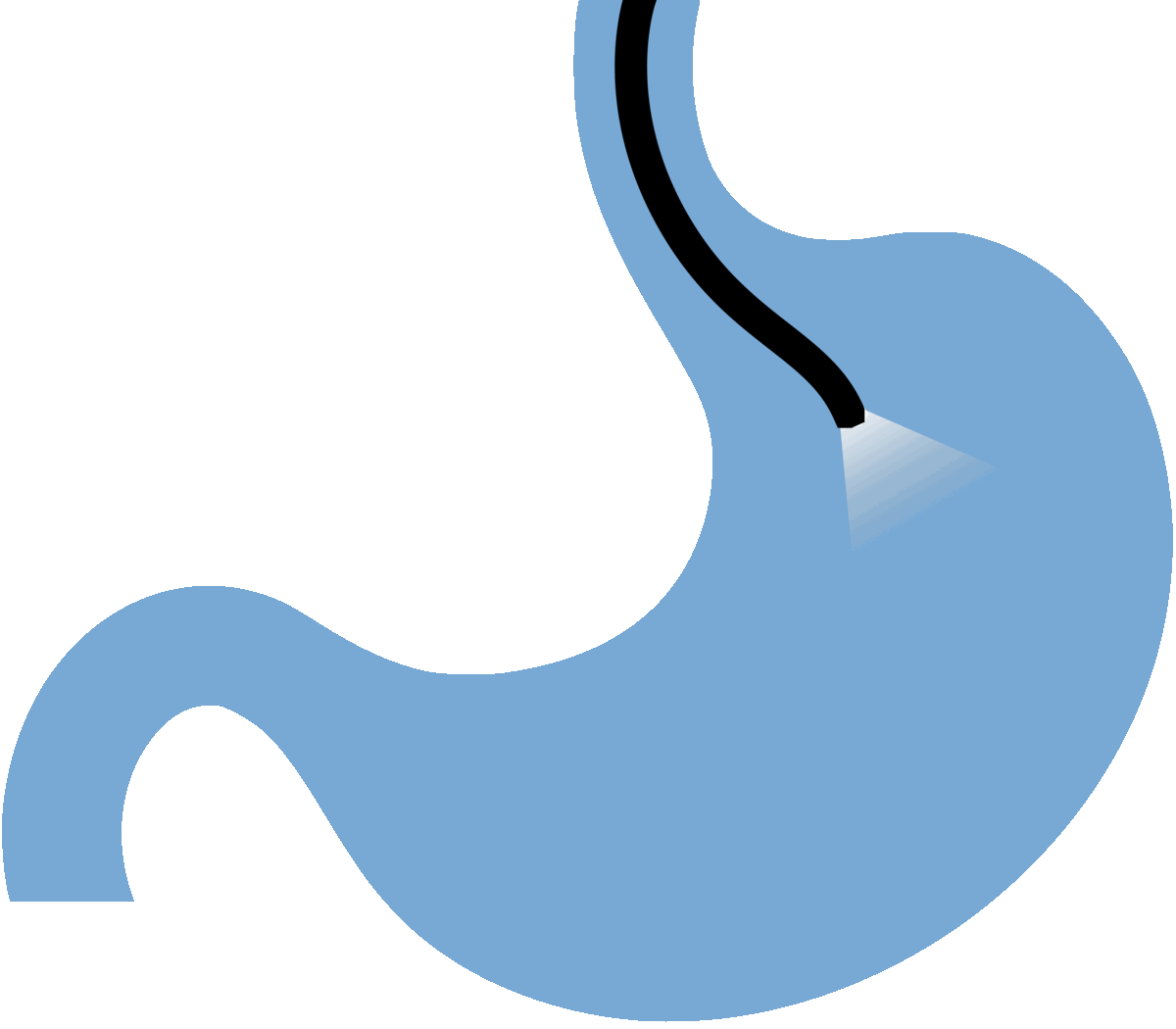 ENDOSCOPIC BALLOON