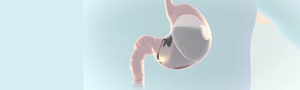 Allurion Balloon